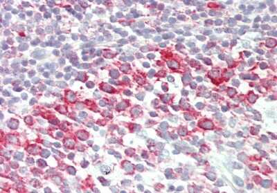 Immunohistochemistry-Paraffin: BRD9 Antibody [NBP2-87083]