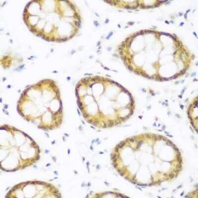 Immunohistochemistry-Paraffin: BRD9 Antibody - BSA Free [NBP3-04971]
