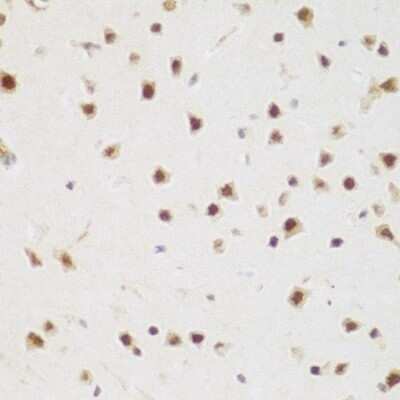 Immunohistochemistry-Paraffin: BRD9 Antibody - BSA Free [NBP3-04971]