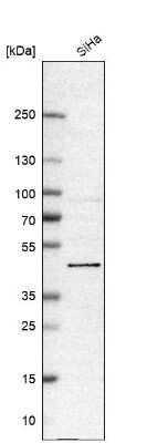 Western Blot: BRD9 Antibody [NBP1-82256]