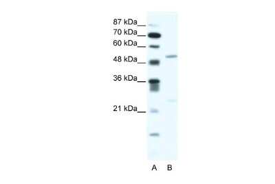 Western Blot: BRD9 Antibody [NBP2-87081]