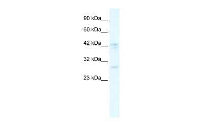 Western Blot: BRD9 Antibody [NBP2-87082]