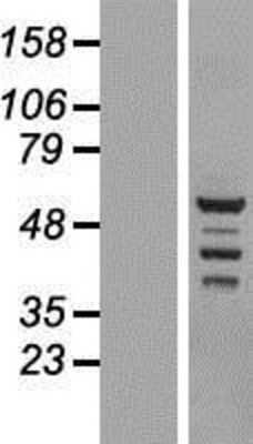 Western Blot: BRD9 Overexpression Lysate [NBL1-08025]