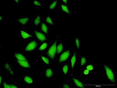 Immunocytochemistry/ Immunofluorescence: BRDG1/STAP-1 Antibody [H00026228-D01P]