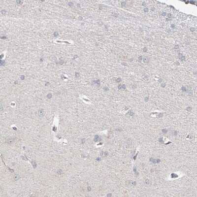 Immunohistochemistry-Paraffin: BRDG1/STAP-1 Antibody [NBP1-89941]