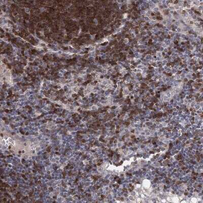 Immunohistochemistry-Paraffin: BRDG1/STAP-1 Antibody [NBP1-89941]
