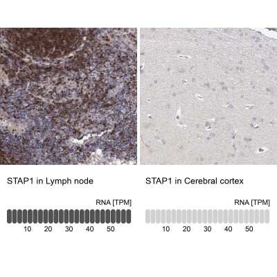 Immunohistochemistry-Paraffin: BRDG1/STAP-1 Antibody [NBP1-89941]