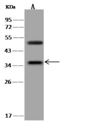 Western Blot: BRDG1/STAP-1 Antibody [NBP3-06491]