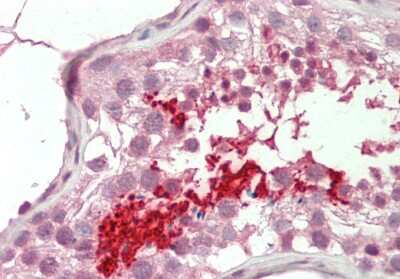 Immunohistochemistry-Paraffin: BRDT Antibody [NBP1-80294]