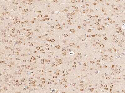 Immunohistochemistry-Paraffin: BRE Antibody [NBP2-99253]