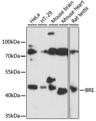 Western Blot: BRE AntibodyAzide and BSA Free [NBP2-92866]