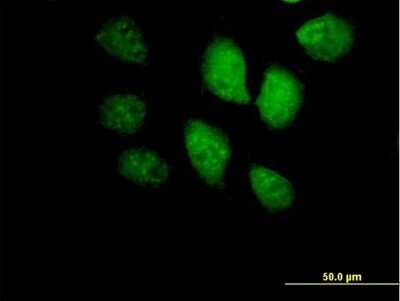 Immunocytochemistry/ Immunofluorescence: BRF1 Antibody [H00002972-B01P]