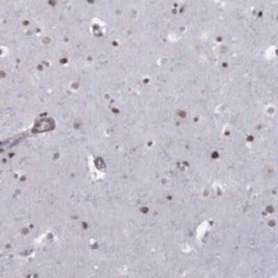 Immunohistochemistry-Paraffin: BRF1 Antibody [NBP3-17809]