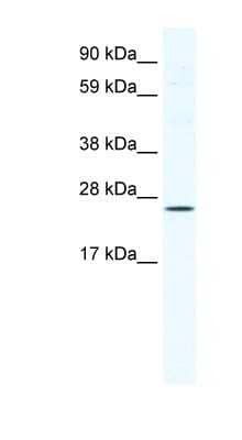 Western Blot: BRF1 Antibody [NBP1-80249]