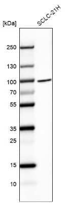 Western Blot: BRF1 Antibody [NBP2-55335]