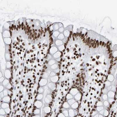Immunohistochemistry-Paraffin: BRF2 Antibody [NBP1-88355]