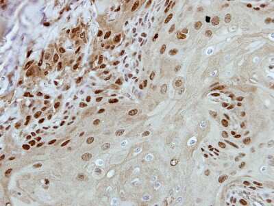 Immunohistochemistry-Paraffin: BRF2 Antibody [NBP2-15617]