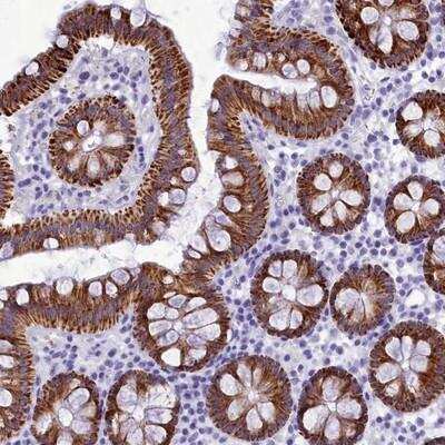 Immunohistochemistry-Paraffin: BRI3 Antibody [NBP1-90969]