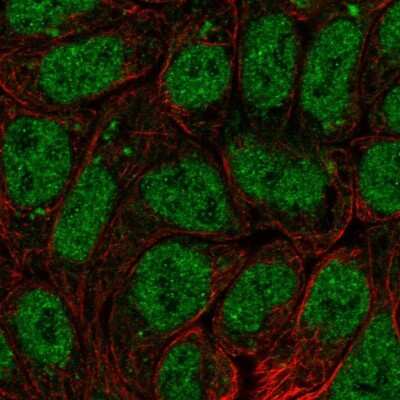 Immunocytochemistry/ Immunofluorescence: BRI3BP Antibody [NBP1-88564]