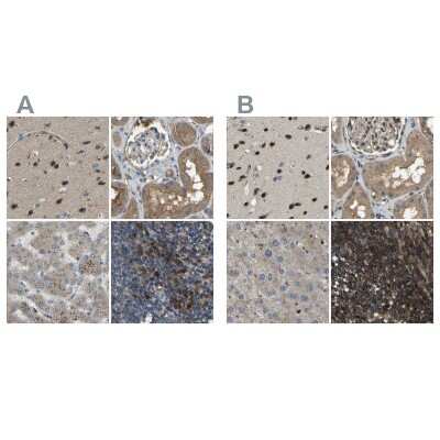 Immunohistochemistry-Paraffin: BRIC Antibody [NBP1-90067]