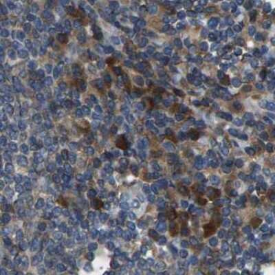 Immunohistochemistry-Paraffin: BRIC Antibody [NBP1-90067]