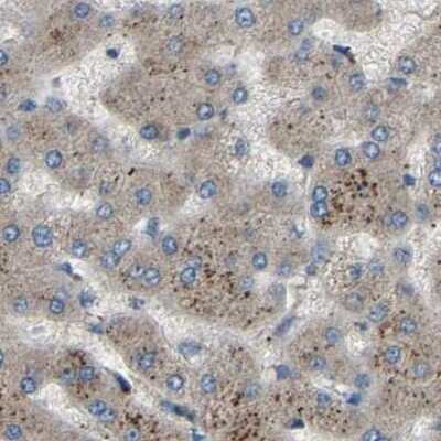 Immunohistochemistry-Paraffin: BRIC Antibody [NBP1-90067]