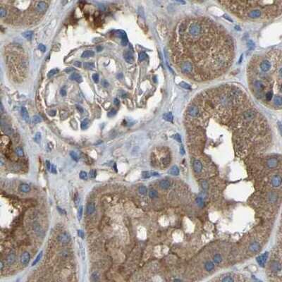 Immunohistochemistry-Paraffin: BRIC Antibody [NBP1-90067]