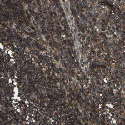 Immunohistochemistry-Paraffin: BRIC Antibody [NBP1-90068]