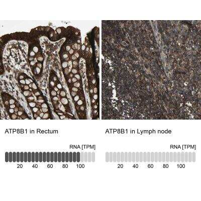 Immunohistochemistry-Paraffin: BRIC Antibody [NBP1-90068]