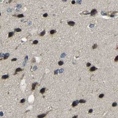 Immunohistochemistry-Paraffin: BRIC Antibody [NBP1-90068]