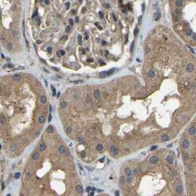 Immunohistochemistry-Paraffin: BRIC Antibody [NBP1-90068]
