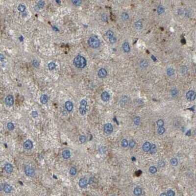 Immunohistochemistry-Paraffin: BRIC Antibody [NBP1-90068]