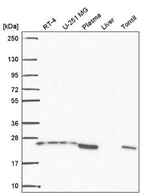 Western Blot: BRICD5 Antibody [NBP2-56405]