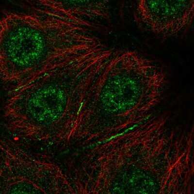 Immunocytochemistry/ Immunofluorescence: BRICK1 Antibody [NBP2-57026]