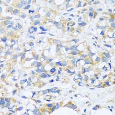 Immunohistochemistry-Paraffin: BRICK1 Antibody - Azide and BSA Free [NBP3-03514]