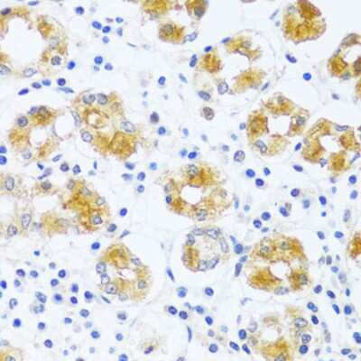 Immunohistochemistry-Paraffin: BRICK1 Antibody - Azide and BSA Free [NBP3-03514]