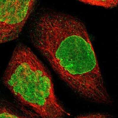 Immunocytochemistry/ Immunofluorescence: BRIP1/FANCJ Antibody [NBP2-14361]