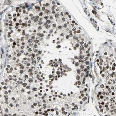 Immunohistochemistry-Paraffin: BRIP1/FANCJ Antibody [NBP2-14361]