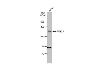 Western Blot: BRIP1/FANCJ Antibody [NBP1-31883]