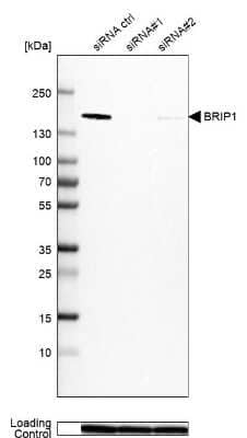 Western Blot: BRIP1/FANCJ Antibody [NBP2-14361]