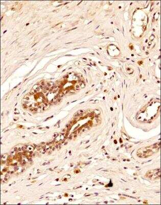 Immunohistochemistry-Paraffin: BRIP1/FANCJ Antibody (pp15-IB4) [NB100-189]