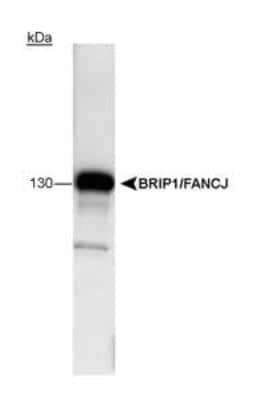 Western Blot: BRIP1/FANCJ Antibody (pp15-IB4) [NB100-189]