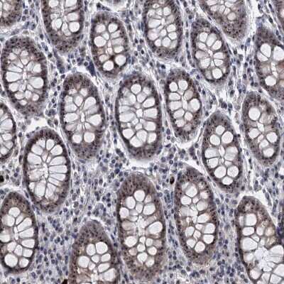 Immunohistochemistry-Paraffin: BRIX Antibody [NBP1-91708]