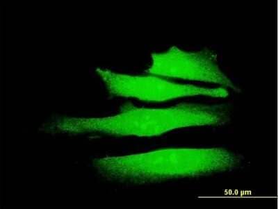 Immunocytochemistry/ Immunofluorescence: BRM Antibody (2D12) [H00006595-M06]