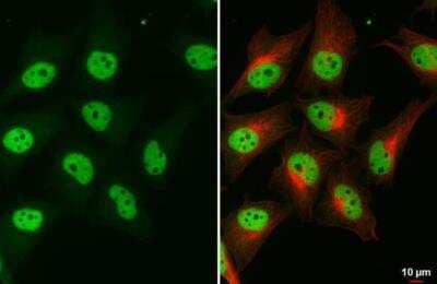 Immunocytochemistry/ Immunofluorescence: BRM Antibody (HL1115) [NBP3-13725]