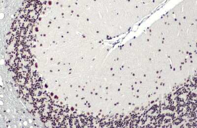 Immunohistochemistry-Paraffin: BRM Antibody (HL1115) [NBP3-13725]