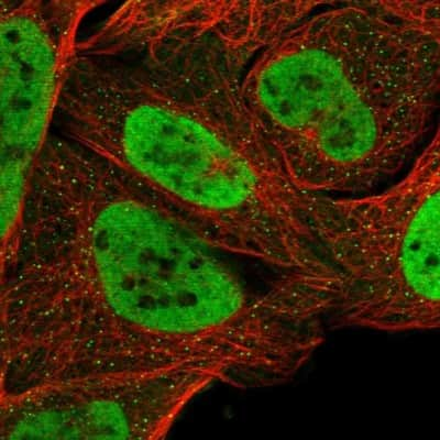 Immunocytochemistry/ Immunofluorescence: BRM Antibody [NBP1-90015]