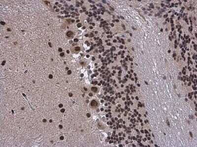 Immunohistochemistry-Paraffin: BRM Antibody [NBP3-13283]