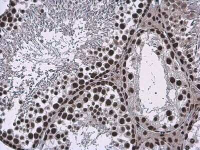 Immunohistochemistry-Paraffin: BRM Antibody [NBP3-13283]