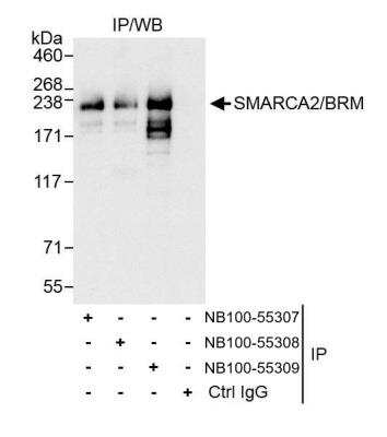 Immunoprecipitation: BRM Antibody [NB100-55309]